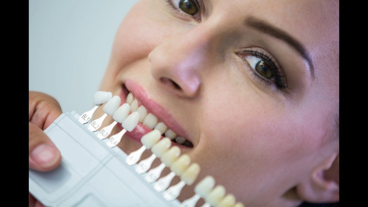 Bone-Graft-Teeth